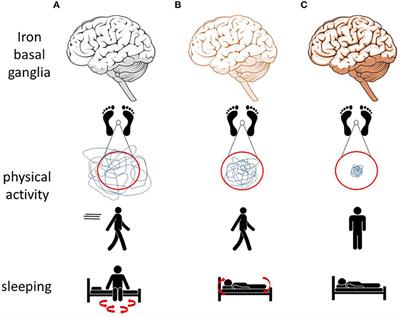 Mobility Deficits Assessed With Mobile Technology: What Can We Learn From Brain Iron-Altered Animal Models?